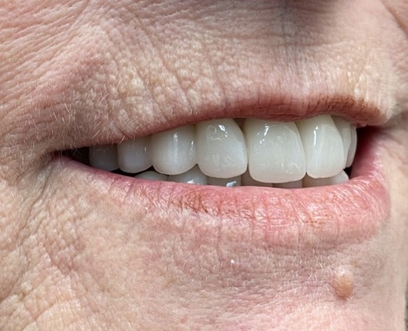 smile gallery image
