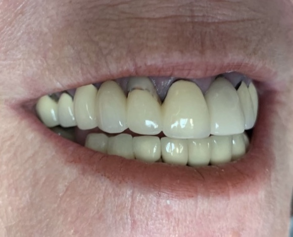 smile gallery image