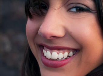 Gummy Smile Treatment: Everything You Need to Know