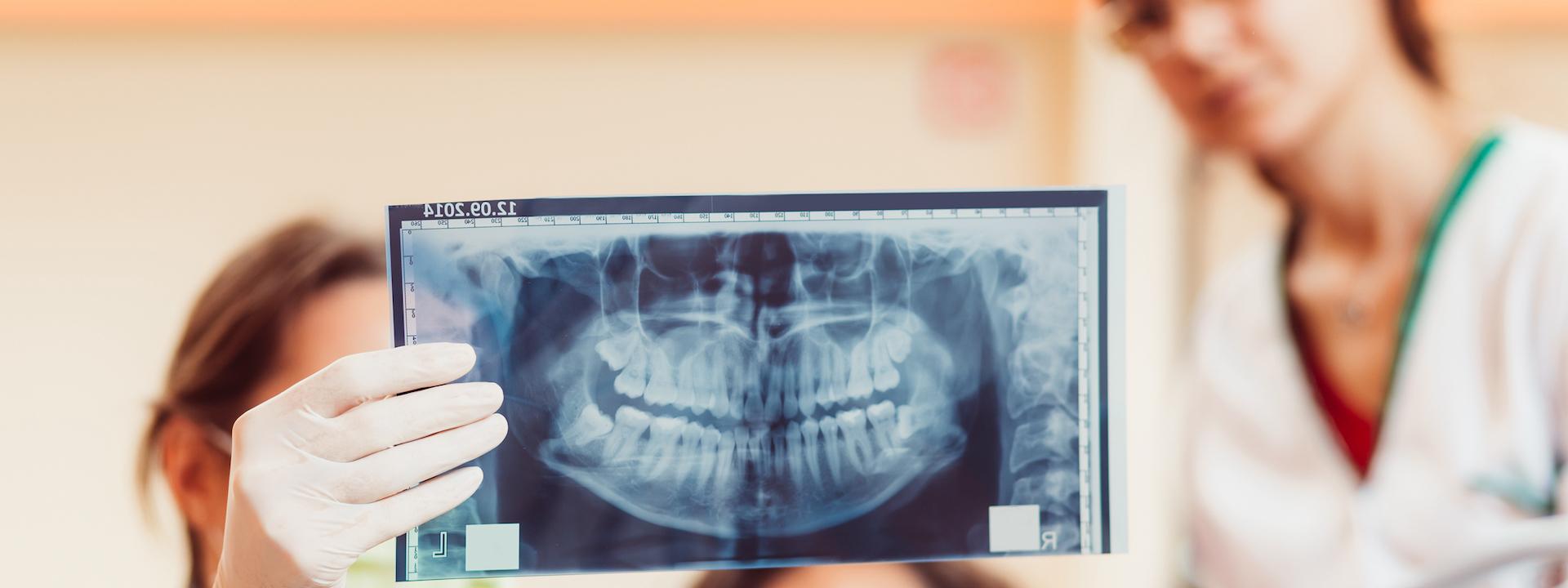 dental-x-ray