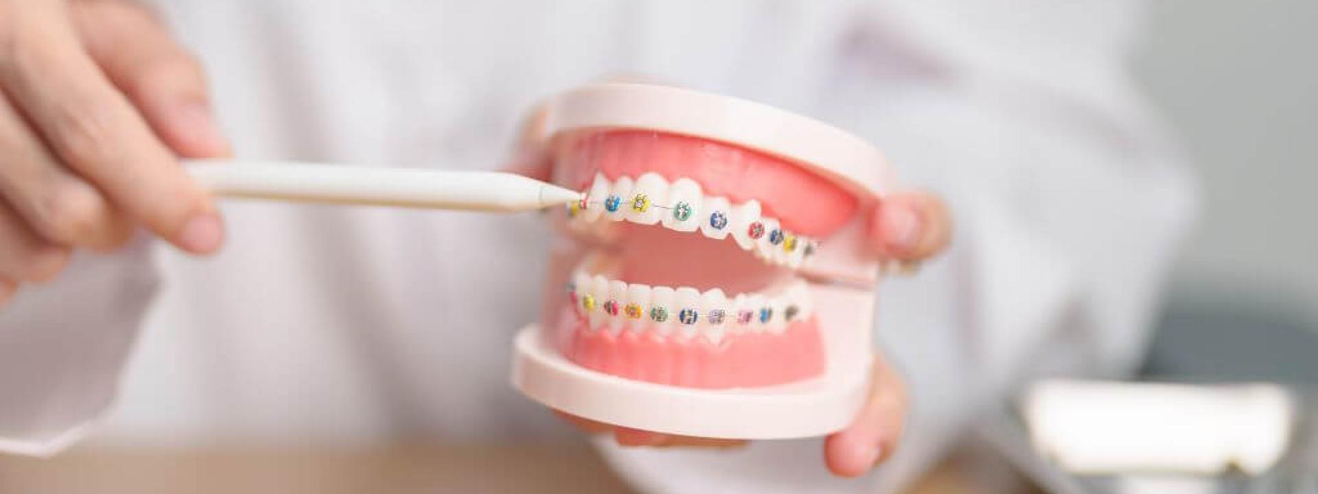 Transform Your Smile: A Comprehensive Look at Orthodontic Care
